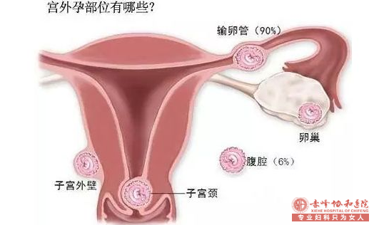 宁德妇科：什么习惯会导致宫外孕的风险增加